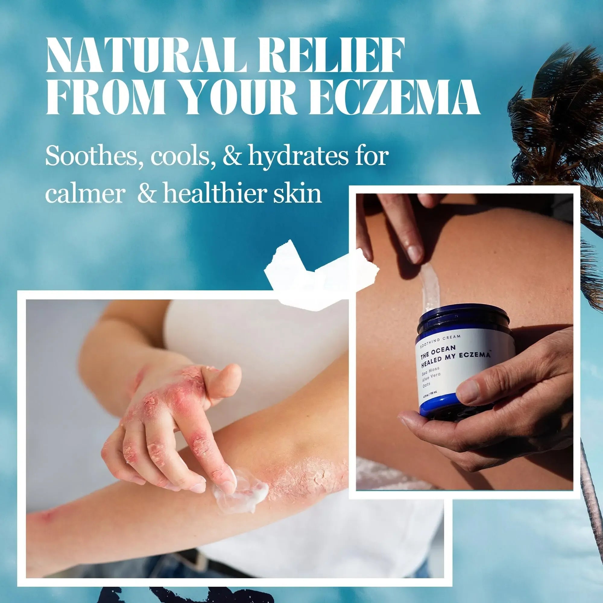 Natural Soothing Cream with Sea Moss & Oats - Eczema & Psoriasis Relief - Ocean Minerals - for Sensitive Skin - Hydrating Eczema Cream for Dry Skin Healing Therapeutic